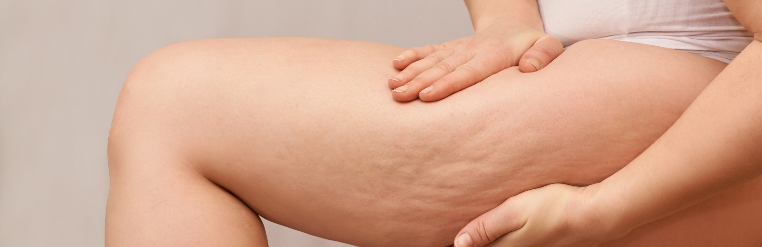 Imagem ilustrativa de curoplastia