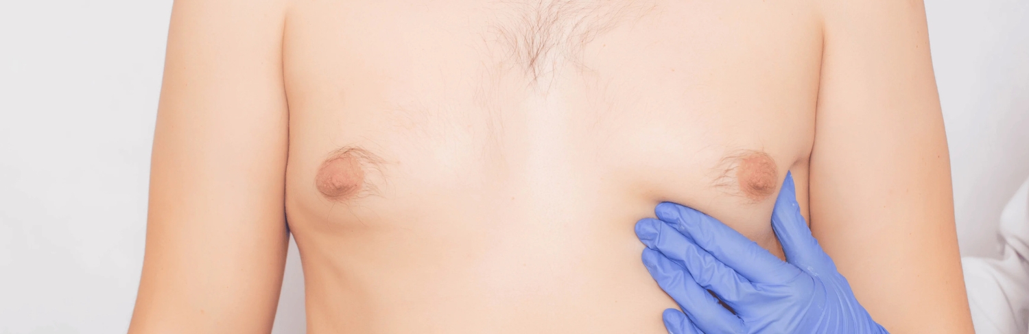 Glúteo esculpido, exemplo.