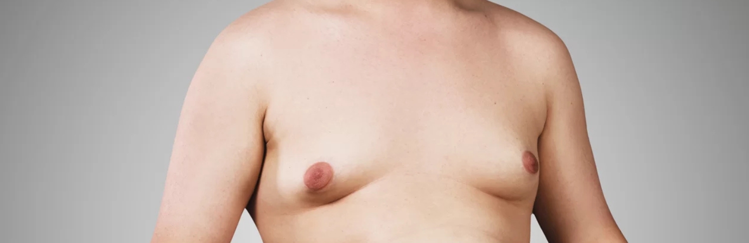 Glúteo esculpido, exemplo.