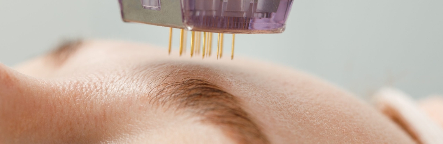 Exemplo de Lipo Ultrassônica.