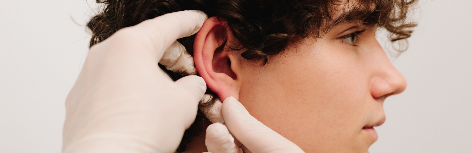 Glúteo esculpido, exemplo.